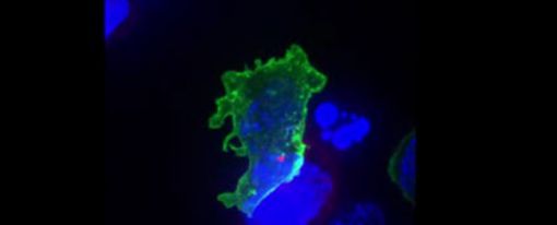 Video de un Linfocito T atacando a una célula cancerígena